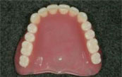 保険義歯